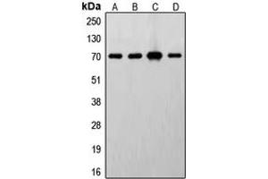Western blot analysis of S6K1 expression in MCF7 (A), HeLa (B), MDCK (C), mouse brain (D) whole cell lysates. (RPS6KB1 antibody  (C-Term))