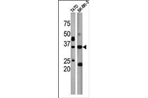 Image no. 1 for anti-Isoprenylcysteine Carboxyl Methyltransferase (ICMT) (C-Term) antibody (ABIN357792) (ICMT antibody  (C-Term))