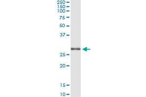 Immunoprecipitation of TRIM72 transfected lysate using anti-TRIM72 monoclonal antibody and Protein A Magnetic Bead , and immunoblotted with TRIM72 MaxPab rabbit polyclonal antibody. (TRIM72 antibody  (AA 378-477))