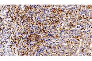 Immunohistochemistry (IHC) image for anti-Colony Stimulating Factor 3 Receptor (Granulocyte) (CSF3R) (AA 26-138) antibody (ABIN7437143)