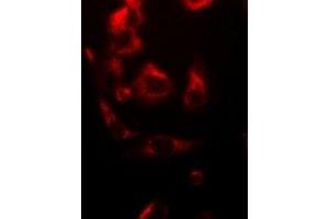 Immunofluorescent analysis of NDUFV1 staining in A549 cells. (NDUFV1 antibody)