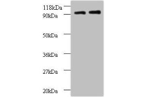 Western blot All lanes: RPS12 antibody at 2 μg/mL Lane 1: EC109 whole cell lysate Lane 2: 293T whole cell lysate Secondary Goat polyclonal to rabbit IgG at 1/15000 dilution Predicted band size: 15 kDa Observed band size: 90 kDa (RPS12 antibody  (AA 1-132))