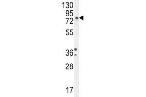 DBH antibody western blot analysis in A2058 lysate (DBH antibody  (AA 27-56))