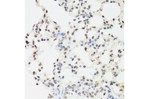 Immunohistochemistry of paraffin-embedded mouse lung using EDF1 antibody.