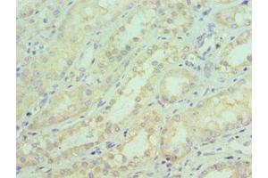 Immunohistochemistry of paraffin-embedded human kidney tissue using ABIN7169843 at dilution of 1:100 (SGTA antibody  (AA 1-120))