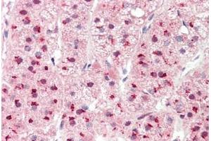 Human Adrenal: Formalin-Fixed, Paraffin-Embedded (FFPE) (PSMD1 antibody  (AA 251-300))