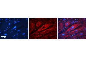 Rabbit Anti-SLC26A3 Antibody  Catalog Number: ARP31608_P050 Formalin Fixed Paraffin Embedded Tissue: Human Adult heart  Observed Staining: Membrane Primary Antibody Concentration: 1:100 Secondary Antibody: Donkey anti-Rabbit-Cy2/3 Secondary Antibody Concentration: 1:200 Magnification: 20X Exposure Time: 0. (SLC26A3 antibody  (Middle Region))