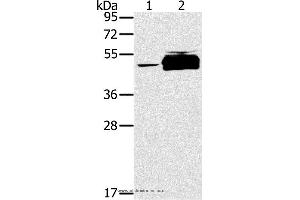 Western blot analysis of K562 cell and human testis tissue, using PTPN20B Polyclonal Antibody at dilution of 1:200