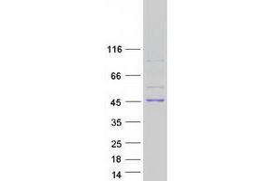 Validation with Western Blot (ADH1C Protein (Myc-DYKDDDDK Tag))