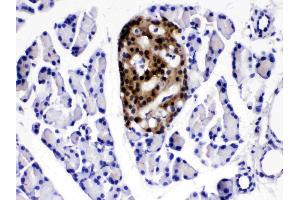IHC analysis of ATP citrate lyase using anti- ATP citrate lyase antibody . (ACLY antibody  (AA 1-180))