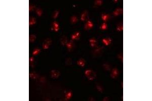 Immunofluorescencent staining of 3T3 cells with ATP2C2 polyclonal antibody  at 20 ug/mL. (ATP2C2 antibody  (N-Term))