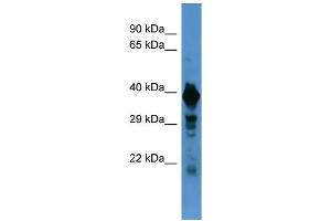 Western Blotting (WB) image for anti-Solute Carrier Family 18 (Vesicular Monoamine Transporter), Member 1 (SLC18A1) (N-Term) antibody (ABIN2505523) (SLC18A1 antibody  (N-Term))