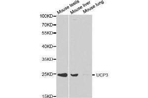 Western blot analysis of extracts of various cell lines, using UCP3 antibody. (UCP3 antibody  (AA 1-110))