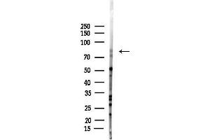 Western blot analysis of lysates from Rat testis, using POSTN Antibody at 1/1000 dilution.