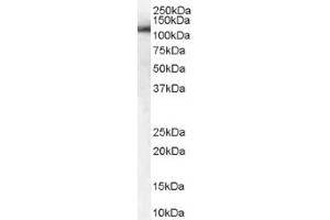 Image no. 1 for anti-USO1 Homolog, Vesicle Docking Protein (USO1) (C-Term) antibody (ABIN374624) (USO1 antibody  (C-Term))