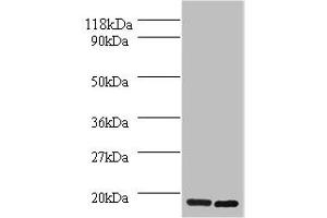 Western blot All lanes: H2AFJ antibody at 2 μg/mL Lane 1: Mouse brain tissue Lane 2: MCF-7 whole cell lysate Secondary Goat polyclonal to rabbit IgG at 1/10000 dilution Predicted band size: 15, 17 kDa Observed band size: 15 kDa (H2AFJ antibody  (AA 2-129))