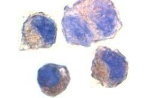 Immunocytochemistry staining of K562 cells using AP30017PU-N ADAM10 antibody at 2 μg/ml. (ADAM10 antibody  (C-Term))