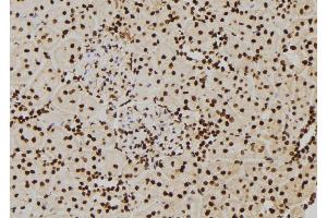 ABIN6277427 at 1/100 staining Rat kidney tissue by IHC-P. (PIWIL2 antibody  (C-Term))