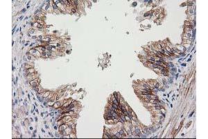 Immunohistochemical staining of paraffin-embedded Human prostate tissue using anti-CDCP1 mouse monoclonal antibody. (CDCP1 antibody)