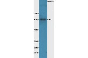 Lane 1: mouse intestinal lysate probed with Rabbit Anti-IL-1R1(Tyr496) Polyclonal Antibody, Unconjugated  at 1:5000 for 90 min at 37˚C. (IL1R1 antibody  (pTyr496))