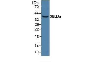 Detection of Recombinant HPR, Human using Polyclonal Antibody to Haptoglobin Related Protein (HPR) (HPR antibody  (AA 70-332))