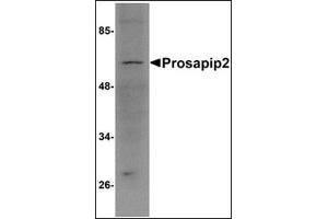 Western blot analysis of Prosapip2 in rat liver tissue lysate with this product at 1 μg/ml. (TBKBP1 antibody  (C-Term))