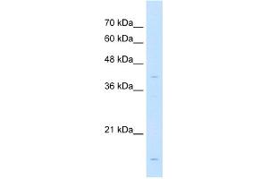 WB Suggested Anti-LMAN2 Antibody Titration:  1 ug/ml  Positive Control:  Jurkat cell lysate
