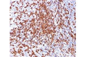 IHC testing of human tonsil stained with HCAM antibody (156-3C11). (CD44 antibody)