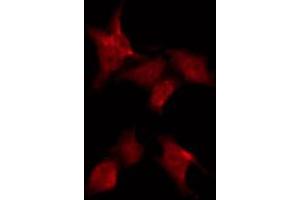 ABIN6269256 staining COS7 by IF/ICC. (SYK antibody)