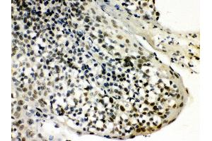 Anti- SNRPN Picoband antibody, IHC(P) IHC(P): Human Tonsil Tissue (SNRPN antibody  (N-Term))