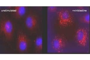 Immunofluorescence (IF) image for anti-Microtubule-Associated Protein 1 Light Chain 3 beta (MAP1LC3B) (N-Term) antibody (ABIN492614) (LC3B antibody  (N-Term))
