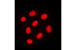Immunofluorescent analysis of HNF4 alpha (pS313) staining in SW480 cells. (HNF4A antibody  (pSer313))