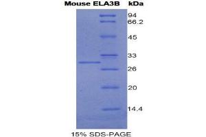 SDS-PAGE (SDS) image for Elastase 3B, Pancreatic (ELA3B) (AA 28-267) protein (His tag) (ABIN1981156)