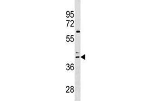 CCR4 antibody western blot analysis in HL-60 lysate (CCR4 antibody  (AA 262-290))