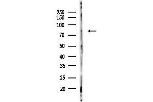 anti-SUMO1/sentrin Specific Peptidase 1 (SENP1) (N-Term) antibody