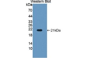 Figure. (Hemoglobin Subunit beta antibody  (AA 1-145))