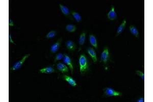 Immunofluorescent analysis of Hela cells using ABIN7169615 at dilution of 1:100 and Alexa Fluor 488-congugated AffiniPure Goat Anti-Rabbit IgG(H+L) (SPCS2 antibody  (AA 7-86))