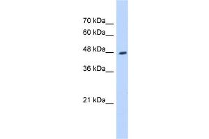 Western Blotting (WB) image for anti-Hydroxyacyl-CoA Dehydrogenase/3-Ketoacyl-CoA Thiolase/enoyl-CoA Hydratase (Trifunctional Protein), beta Subunit (HADHB) (C-Term) antibody (ABIN2783232)