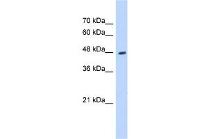 WB Suggested Anti-HADHB Antibody Titration:  0. (HADHB antibody  (C-Term))