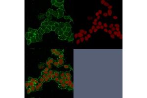 Confocal immunofluorescence image of HeLa cells using Catenin, gamma Mouse Monoclonal Antibody (15F11) Green (CF488) and Reddot is used to label the nuclei Red. (JUP antibody)
