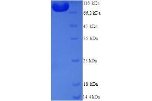 SDS-PAGE (SDS) image for 5-Methyltetrahydrofolate-Homocysteine Methyltransferase Reductase (MTRR) (AA 1-725), (full length) protein (His tag) (ABIN5714506)