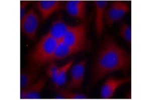 Image no. 2 for anti-Cyclin-Dependent Kinase 1 (CDK1) (Thr161) antibody (ABIN197352) (CDK1 antibody  (Thr161))