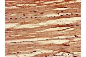 Immunohistochemistry of paraffin-embedded human skeletal muscle tissue using ABIN7152425 at dilution of 1:100 (F-Box Protein 3 antibody  (AA 276-376))