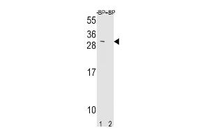 Western blot analysis of TIMP3 Antibody Pab pre-incubated without(lane 1) and with(lane 2) blocking peptide in mouse NIH-3T3 cell line lysate. (TIMP3 antibody  (AA 113-139))