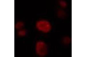 ABIN6274322 staining LOVO cells by IF/ICC. (SRSF4 antibody  (Internal Region))