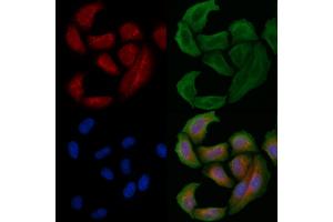 ABIN6261604 and ABIN6266802 staining Hela cells by IF/ICC.