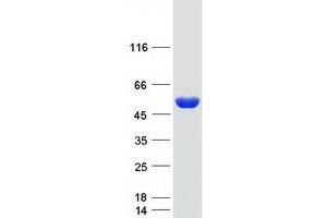 Validation with Western Blot (ADSSL1 Protein (Transcript Variant 2) (Myc-DYKDDDDK Tag))