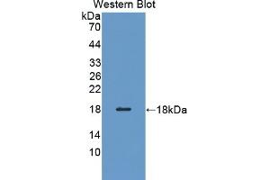 Detection of Recombinant PFN3, Human using Polyclonal Antibody to Profilin 3 (PFN3) (Profilin 3 antibody  (AA 1-133))