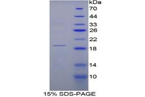 SDS-PAGE analysis of Rat RNASE3 Protein. (RNASE3 Protein)