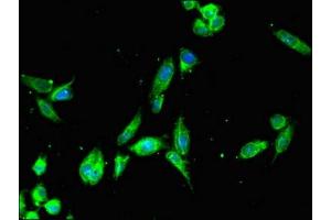 Immunofluorescent analysis of Hela cells using ABIN7165450 at dilution of 1:100 and Alexa Fluor 488-congugated AffiniPure Goat Anti-Rabbit IgG(H+L) (FAM182A antibody  (AA 1-154))